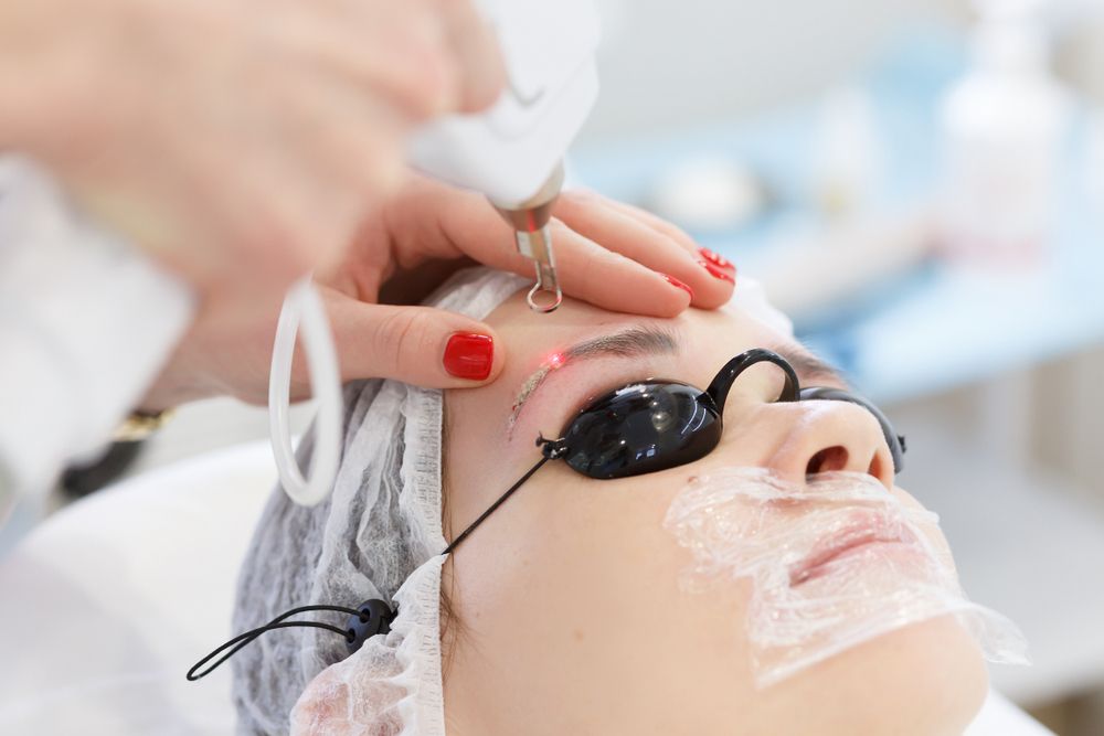 Eliminar-microblading-con-laser-Q
