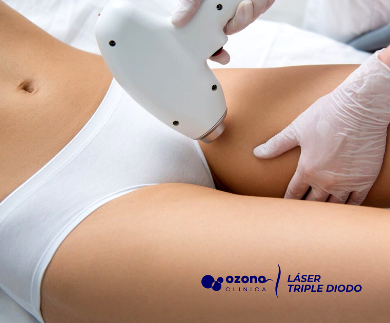Depilación láser zona íntima – Tecnología triple diodo en Ozonoclinica