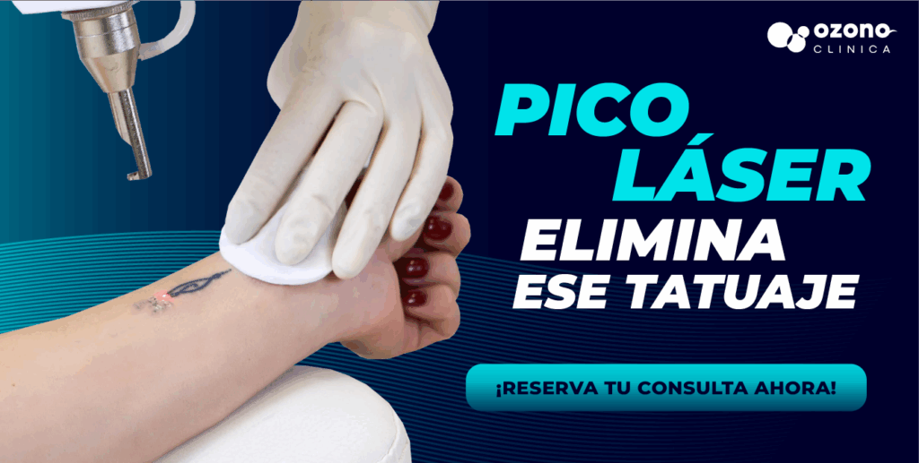 Imagen promocional de tratamiento con láser para eliminación de tatuajes en una muñeca. Un profesional con guantes sostiene una gasa mientras aplica el láser. El texto dice: “Pico Láser elimina ese tatuaje. ¡Reserva tu consulta ahora!”