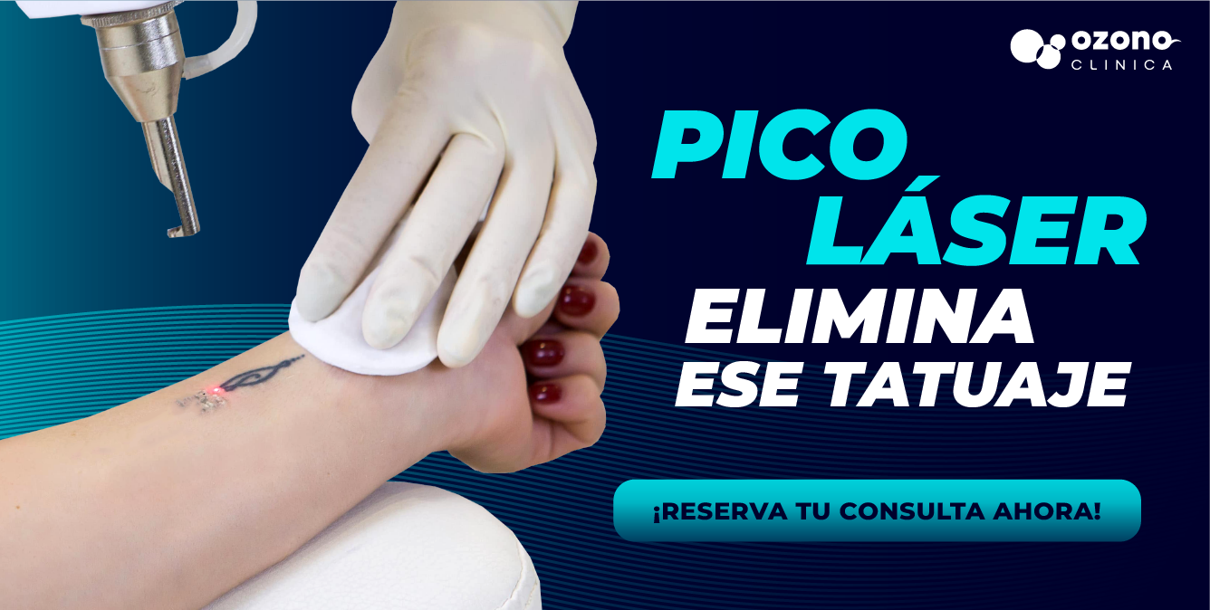 Imagen promocional de tratamiento con láser para eliminación de tatuajes en una muñeca. Un profesional con guantes sostiene una gasa mientras aplica el láser. El texto dice: “Pico Láser elimina ese tatuaje. ¡Reserva tu consulta ahora!”