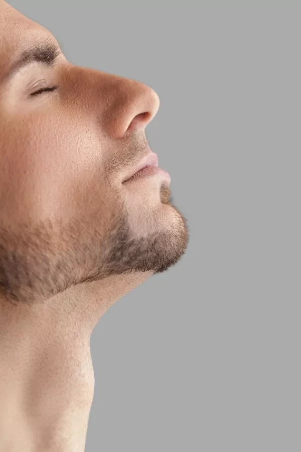 Antes-y-despues-del-implante-de-barba