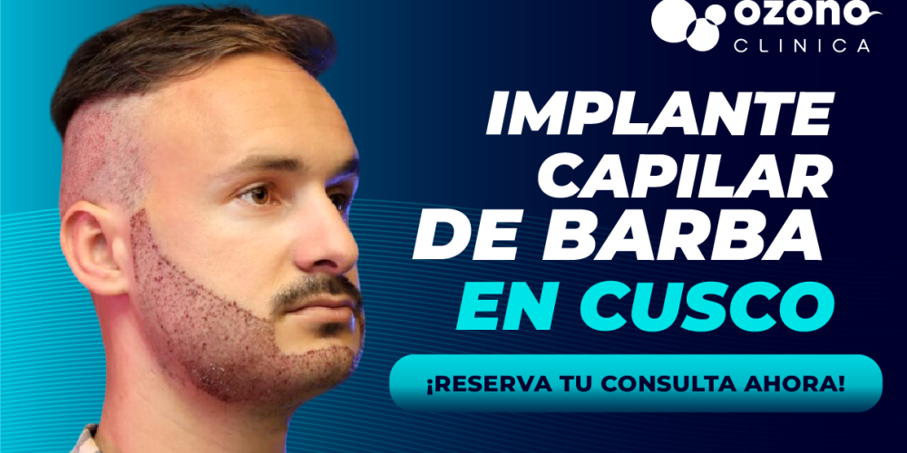 implantedebarba1-03 (3)