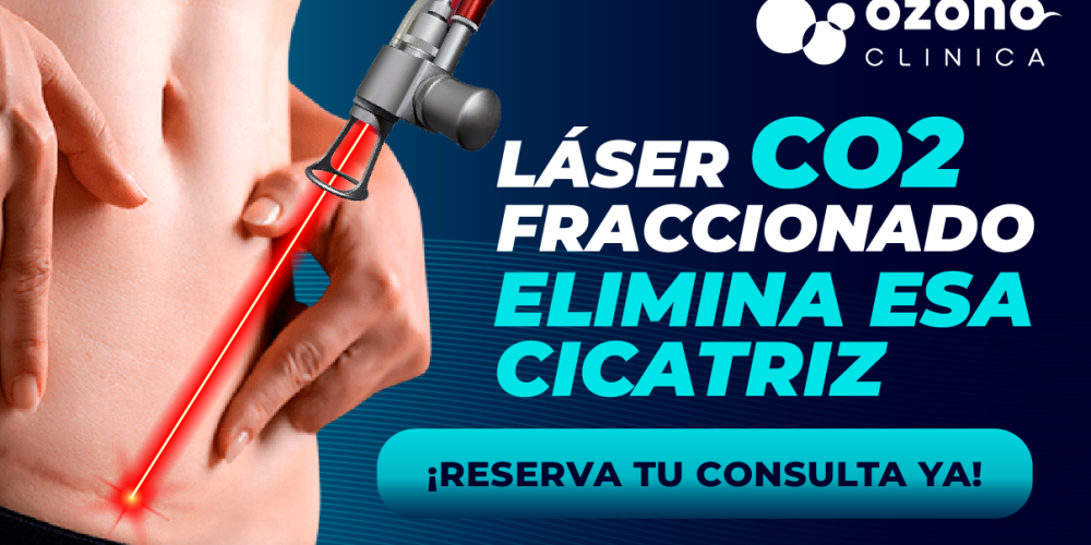 laser co2cicatrices2-02